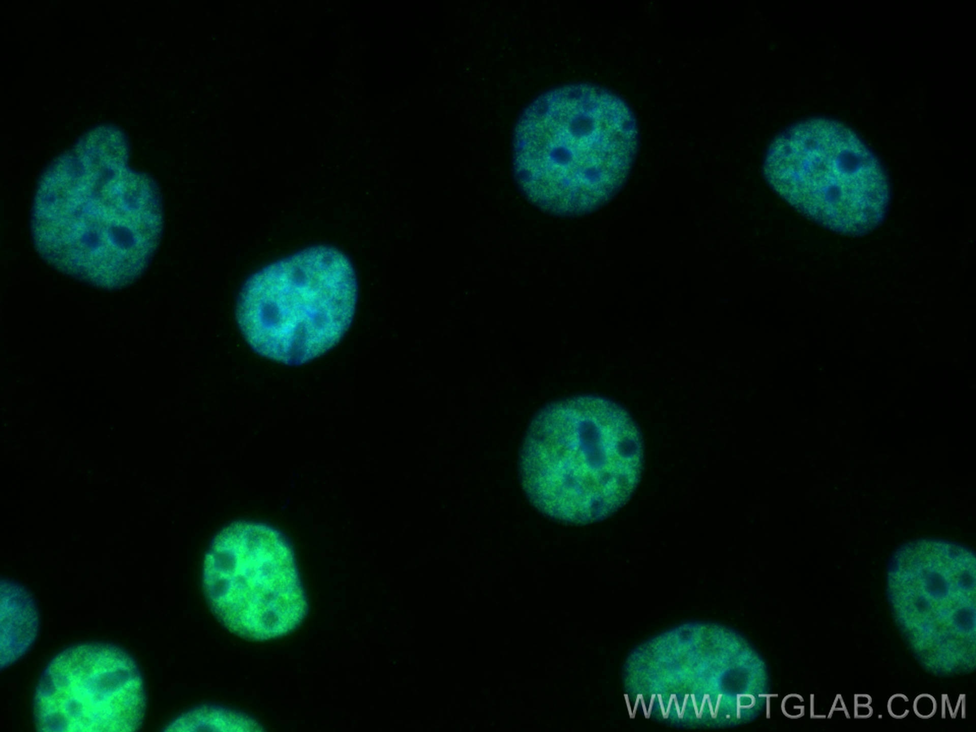 Immunofluorescence (IF) / fluorescent staining of HuH-7 cells using PROX1 Monoclonal antibody (67438-1-Ig)