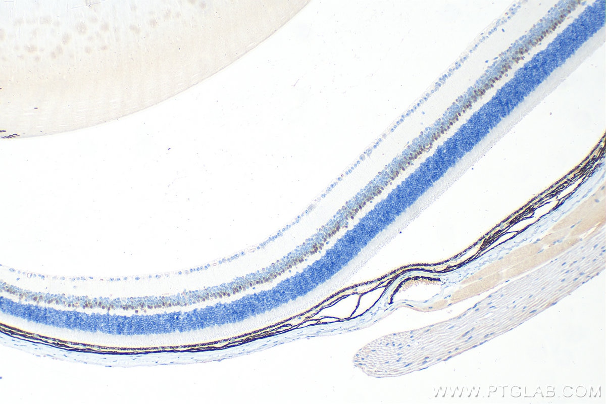 Immunohistochemical analysis of paraffin-embedded mouse eye tissue slide using 67438-1-Ig (PROX1 antibody) at dilution of 1:2000 (under 10x lens). Heat mediated antigen retrieval with Tris-EDTA buffer (pH 9.0). Immunohistochemistry (IHC) staining of mouse eye tissue using PROX1 Monoclonal antibody (67438-1-Ig)
