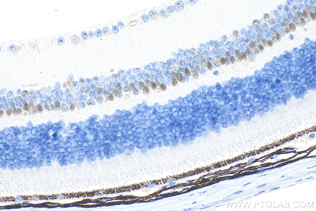 Immunohistochemical analysis of paraffin-embedded mouse eye tissue slide using 67438-1-Ig (PROX1 antibody) at dilution of 1:2000 (under 40x lens). Heat mediated antigen retrieval with Tris-EDTA buffer (pH 9.0). Immunohistochemistry (IHC) staining of mouse eye tissue using PROX1 Monoclonal antibody (67438-1-Ig)