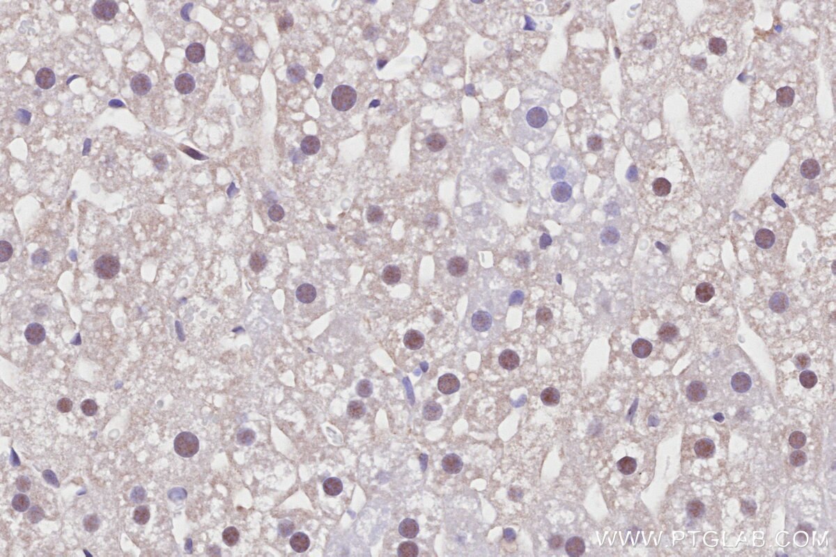 Immunohistochemistry (IHC) staining of mouse liver tissue using PROX1 Recombinant monoclonal antibody (81778-1-RR)