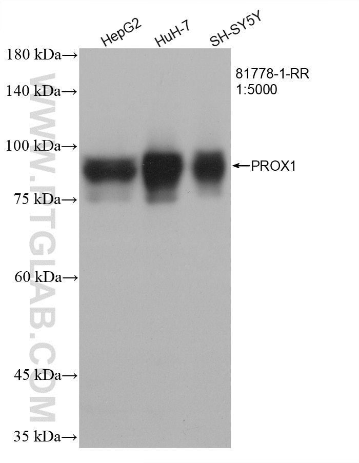 Western Blot (WB) analysis of various lysates using PROX1 Recombinant antibody (81778-1-RR)