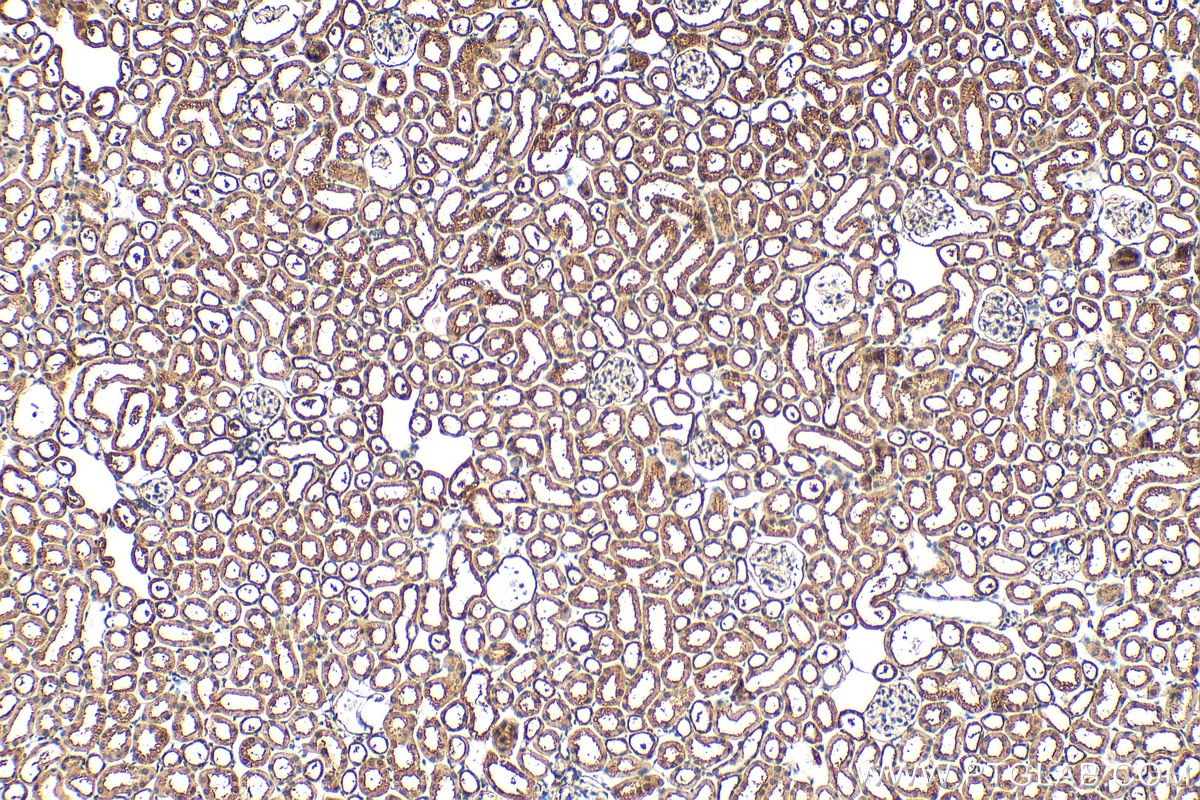 Immunohistochemistry (IHC) staining of mouse kidney tissue using PRPF19 Polyclonal antibody (15414-1-AP)