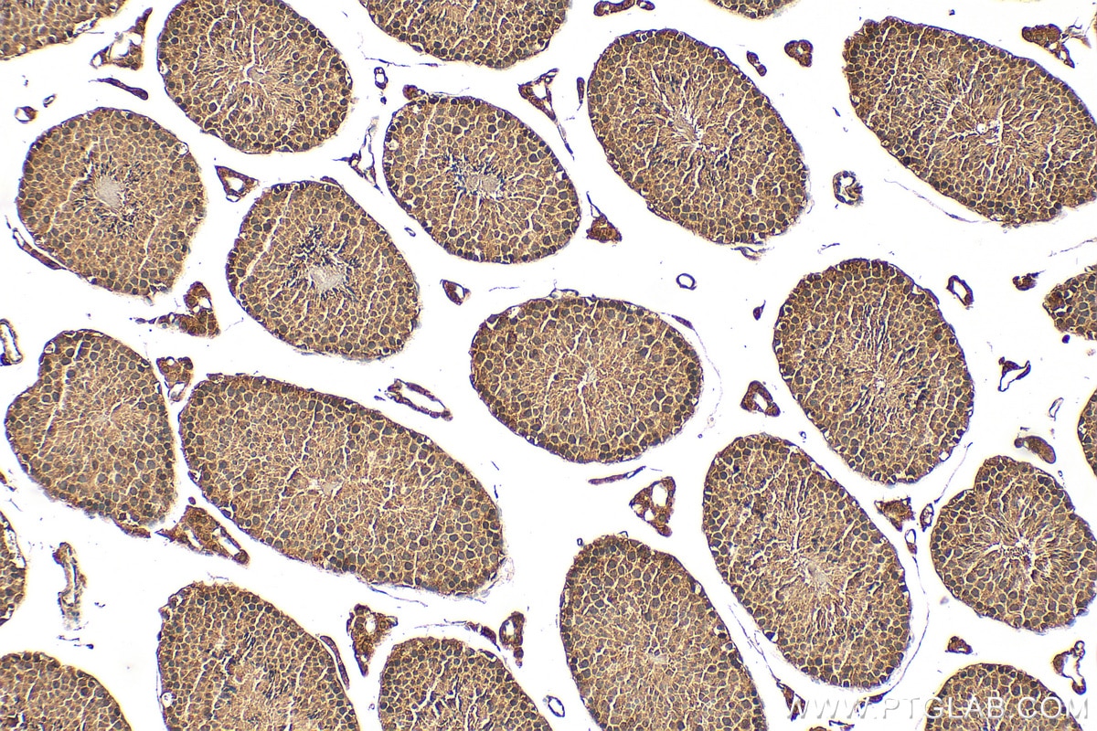 Immunohistochemistry (IHC) staining of mouse testis tissue using PRPF19 Polyclonal antibody (15414-1-AP)