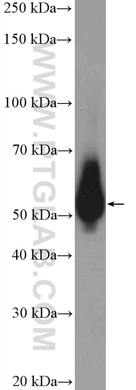 Western Blot (WB) analysis of rat kidney tissue using PRPF19 Polyclonal antibody (15414-1-AP)