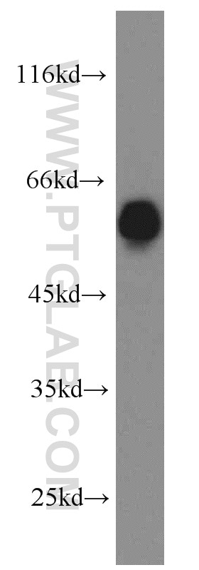 Western Blot (WB) analysis of HEK-293 cells using PRPF19 Polyclonal antibody (15414-1-AP)