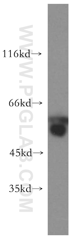 Western Blot (WB) analysis of HeLa cells using PRPF19 Polyclonal antibody (15414-1-AP)