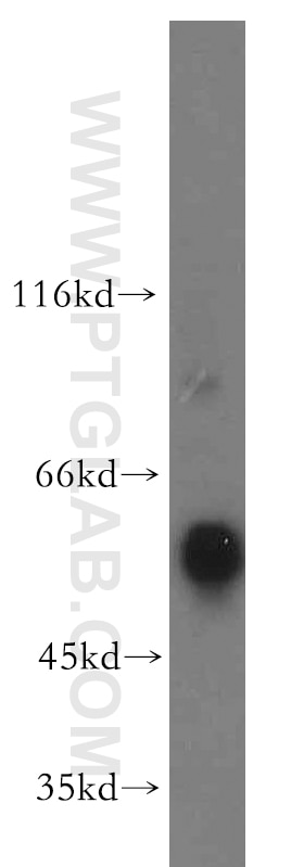 WB analysis of human testis using 15414-1-AP