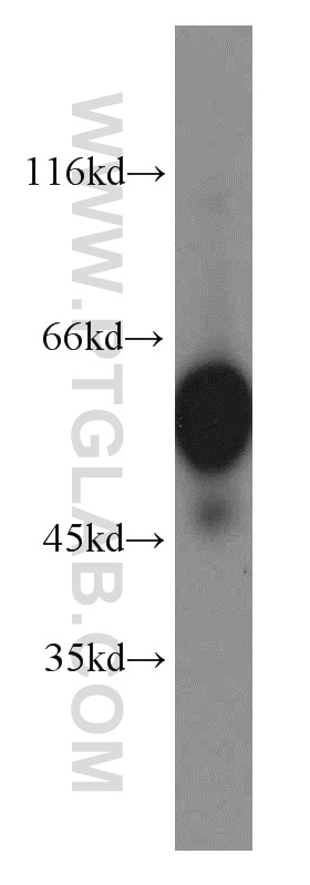 Western Blot (WB) analysis of PC-3 cells using PRPF19 Polyclonal antibody (15414-1-AP)