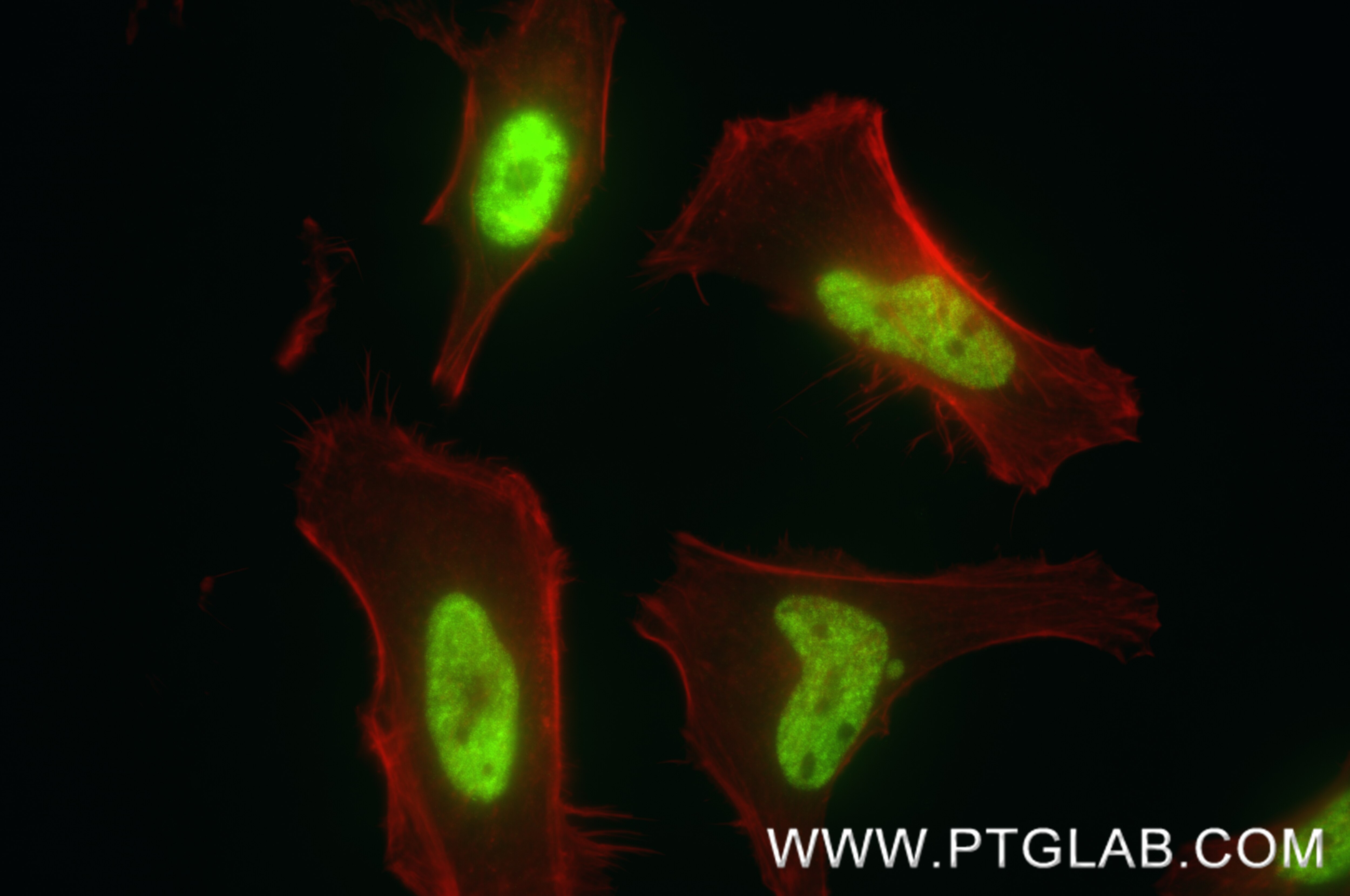 IF Staining of HeLa using 88331-1-RR Immunofluorescence (IF) / fluorescent staining of HeLa cells using PRPF19 Recombinant monoclonal antibody (88331-1-RR)