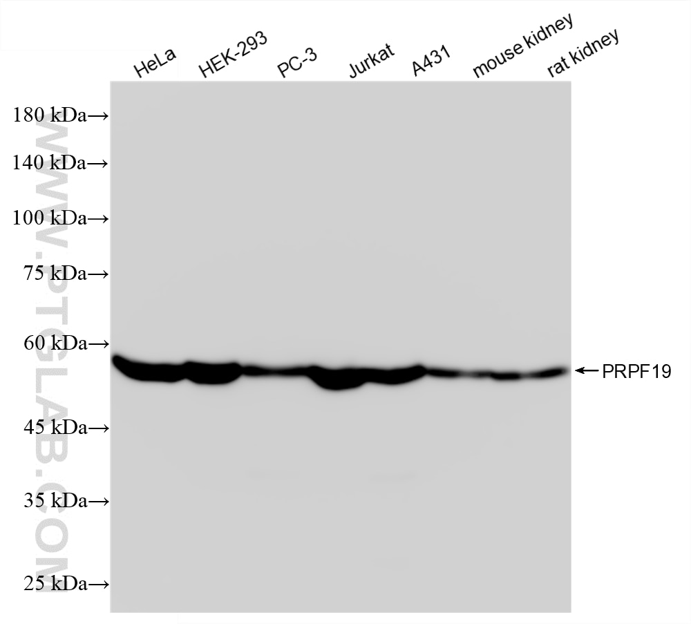 WB analysis using 88331-1-RR Western Blot (WB) analysis of various lysates using PRPF19 Recombinant monoclonal antibody (88331-1-RR)