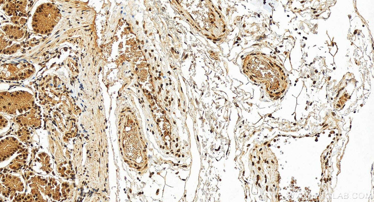 Immunohistochemistry (IHC) staining of human stomach tissue using PRPF3 Polyclonal antibody (10106-1-AP)