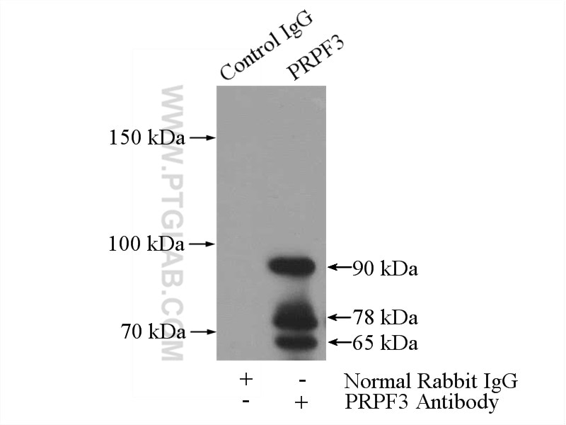 Immunoprecipitation (IP) experiment of mouse liver tissue using PRPF3 Polyclonal antibody (10106-1-AP)