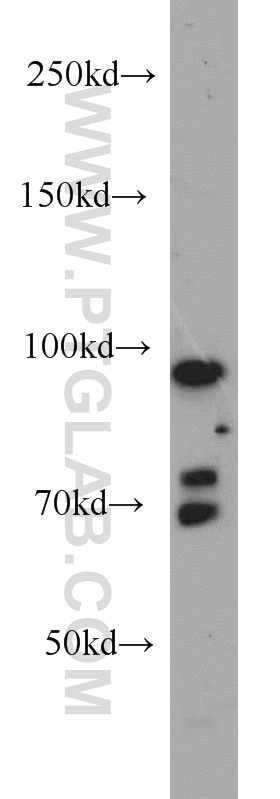 Western Blot (WB) analysis of HepG2 cells using PRPF3 Polyclonal antibody (10106-1-AP)