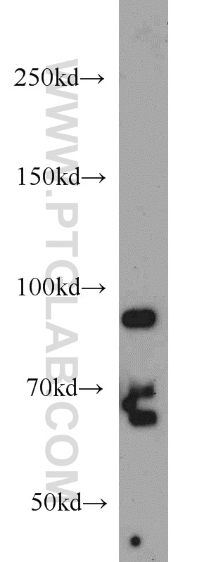 Western Blot (WB) analysis of L02 cells using PRPF3 Polyclonal antibody (10106-1-AP)