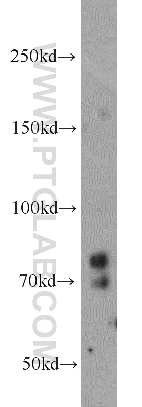 Western Blot (WB) analysis of mouse liver tissue using PRPF3 Polyclonal antibody (10106-1-AP)