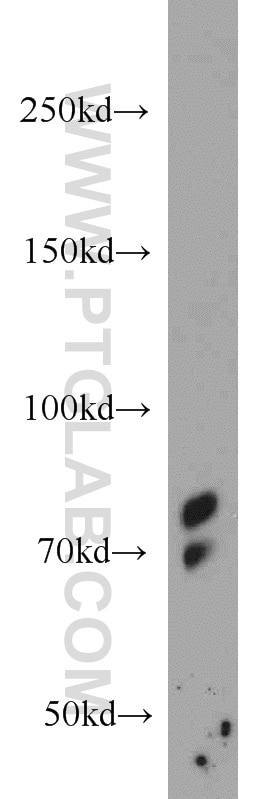 Western Blot (WB) analysis of mouse liver tissue using PRPF3 Polyclonal antibody (10106-1-AP)