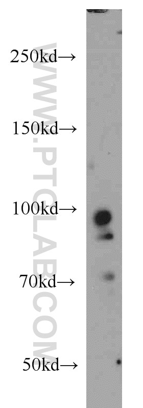 Western Blot (WB) analysis of mouse brain tissue using PRPF3 Polyclonal antibody (10106-1-AP)