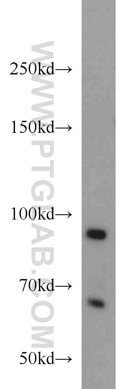 Western Blot (WB) analysis of Y79 cells using PRPF3 Polyclonal antibody (10106-1-AP)