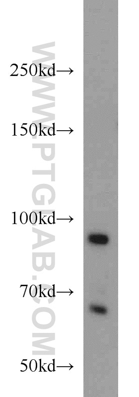 Western Blot (WB) analysis of Y79 cells using PRPF3 Polyclonal antibody (10106-1-AP)
