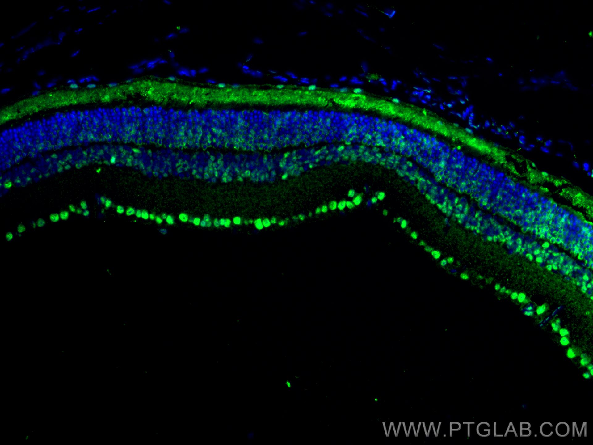 Immunofluorescence (IF) / fluorescent staining of mouse eye tissue using PRPF31 Polyclonal antibody (27750-1-AP)