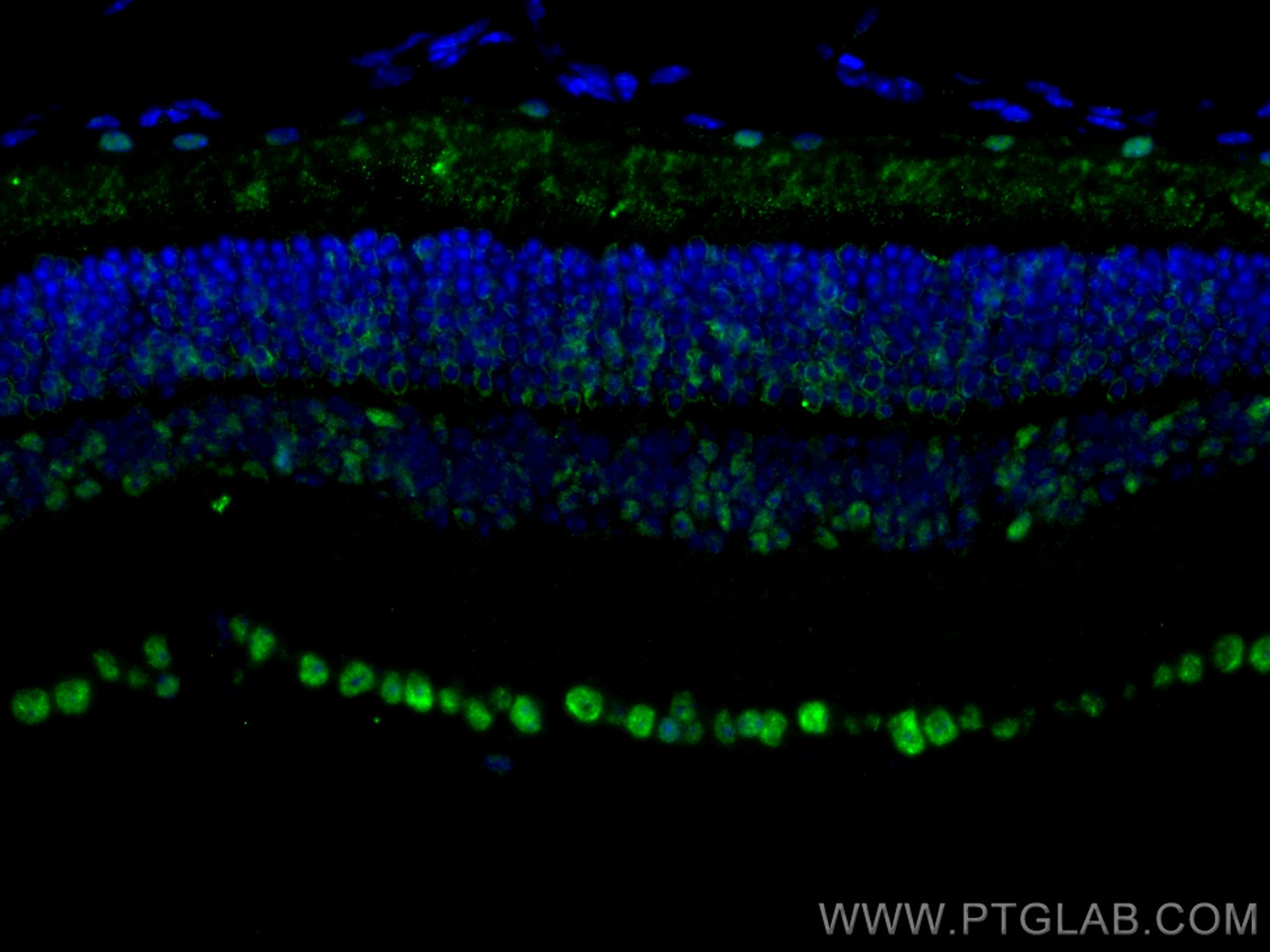 Immunofluorescence (IF) / fluorescent staining of mouse eye tissue using PRPF31 Polyclonal antibody (27750-1-AP)