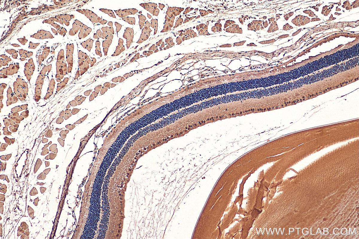 Immunohistochemistry (IHC) staining of mouse eye tissue using PRPF31 Polyclonal antibody (27750-1-AP)