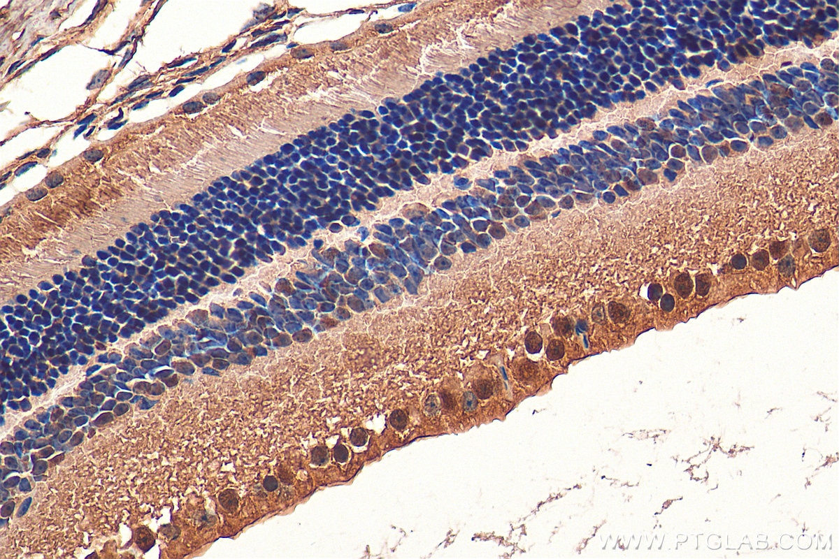 Immunohistochemistry (IHC) staining of mouse eye tissue using PRPF31 Polyclonal antibody (27750-1-AP)