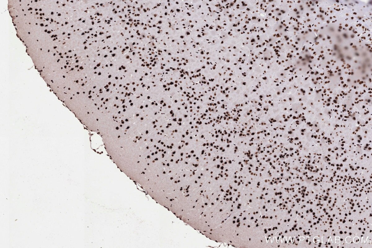 Immunohistochemistry (IHC) staining of mouse brain tissue using PRPF31 Recombinant monoclonal antibody (86315-1-RR)