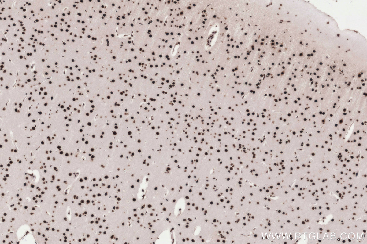 Immunohistochemistry (IHC) staining of rat brain tissue using PRPF31 Recombinant monoclonal antibody (86315-1-RR)