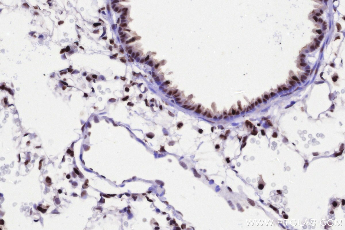 Immunohistochemistry (IHC) staining of rat lung tissue using PRPF31 Recombinant monoclonal antibody (86315-1-RR)