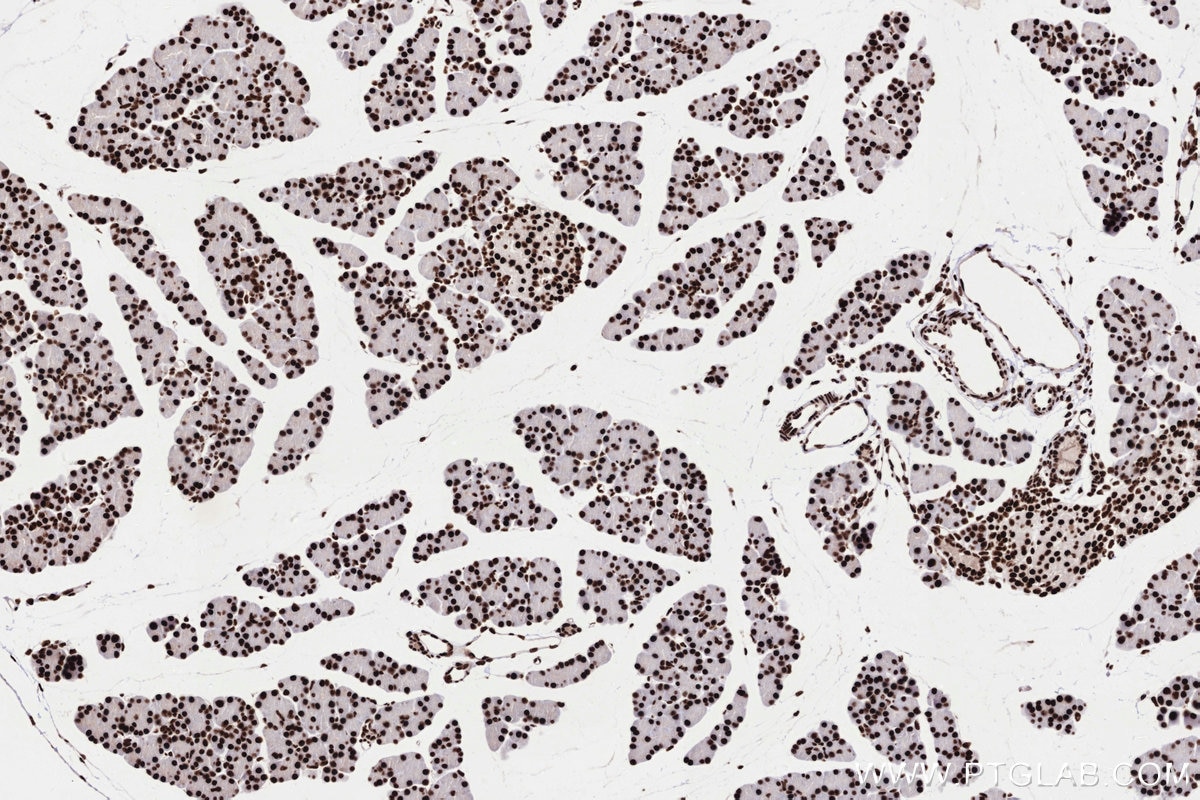 Immunohistochemistry (IHC) staining of rat pancreas tissue using PRPF31 Recombinant monoclonal antibody (86315-1-RR)
