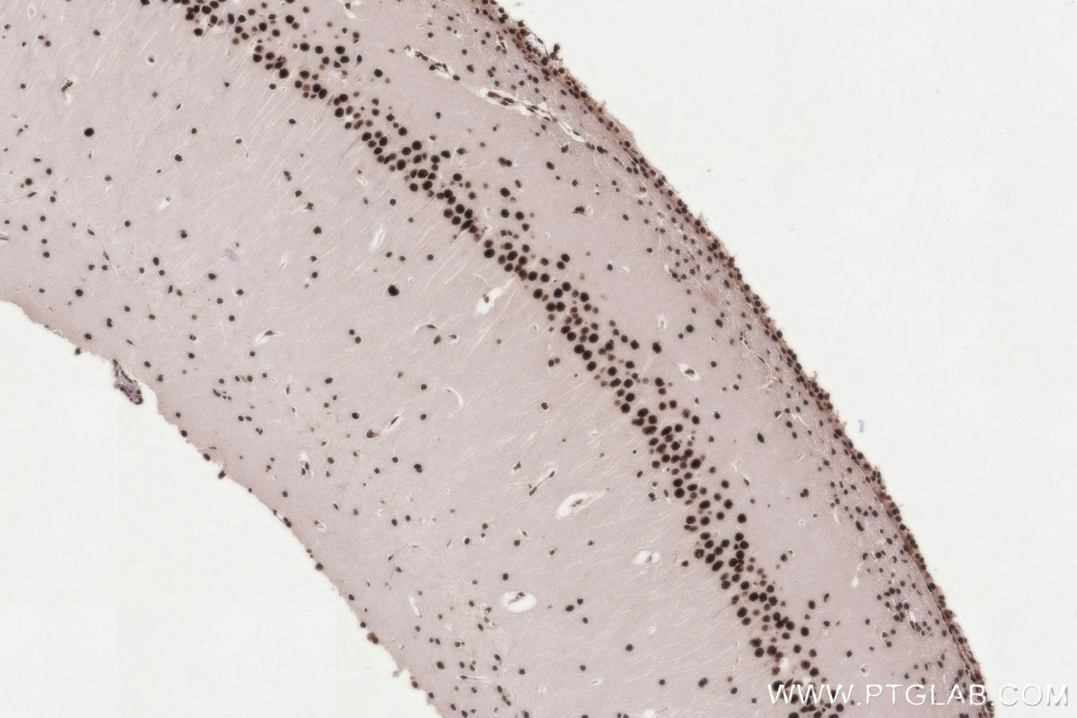 Immunohistochemistry (IHC) staining of rat brain tissue using PRPF31 Recombinant monoclonal antibody (86315-1-RR)
