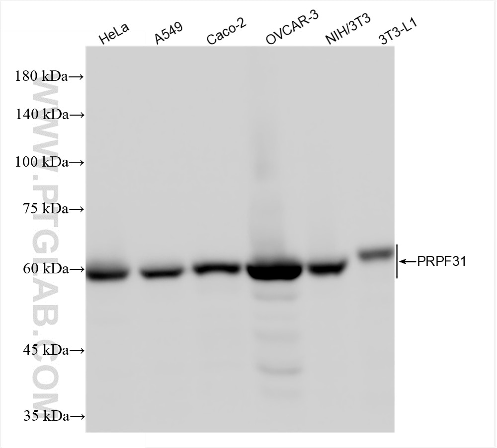 Western Blot (WB) analysis of various lysates using PRPF31 Recombinant antibody (86315-1-RR)