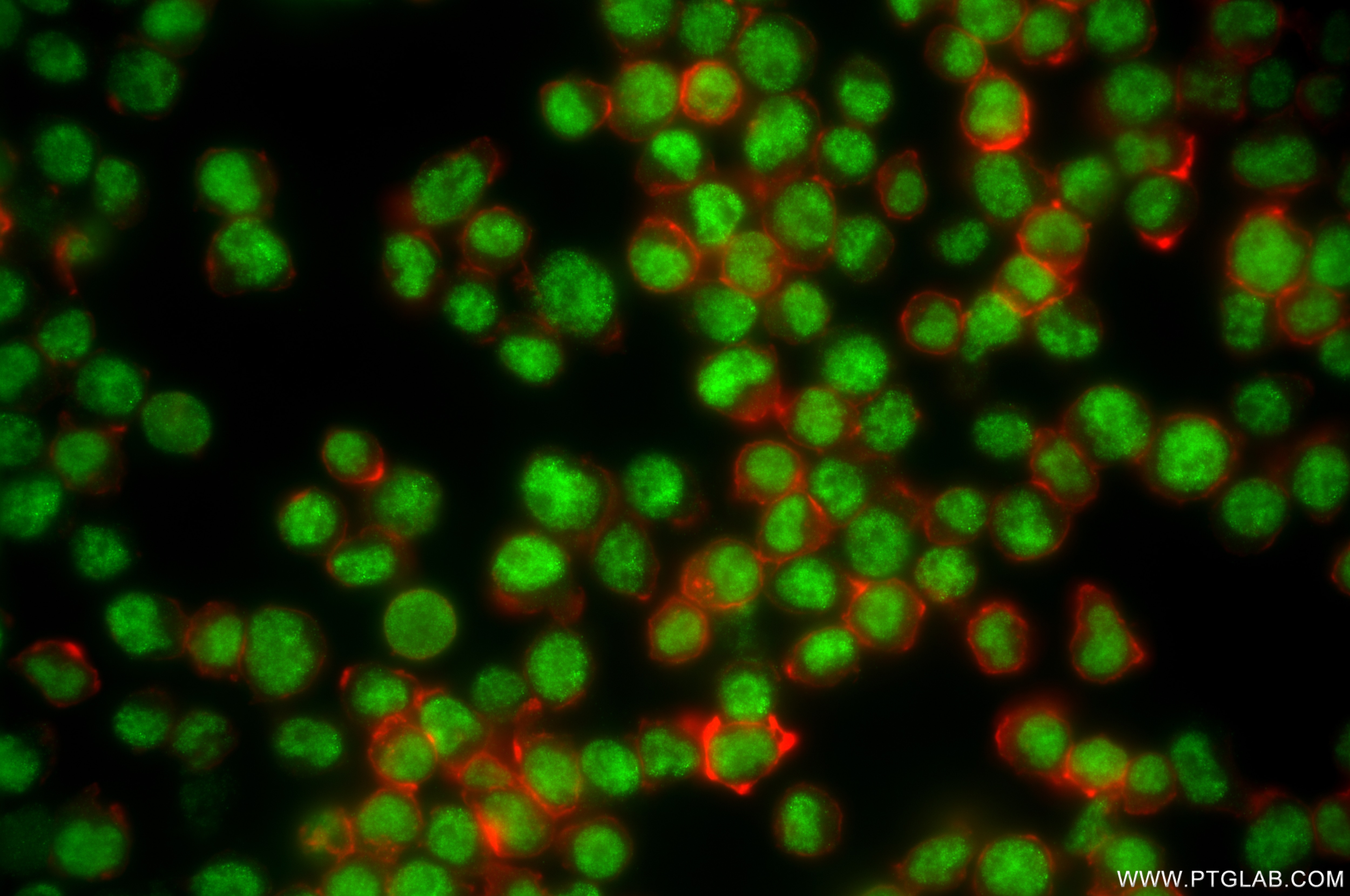 Immunofluorescence (IF) / fluorescent staining of Jurkat cells using PRPF31 Recombinant antibody (86315-2-RR)