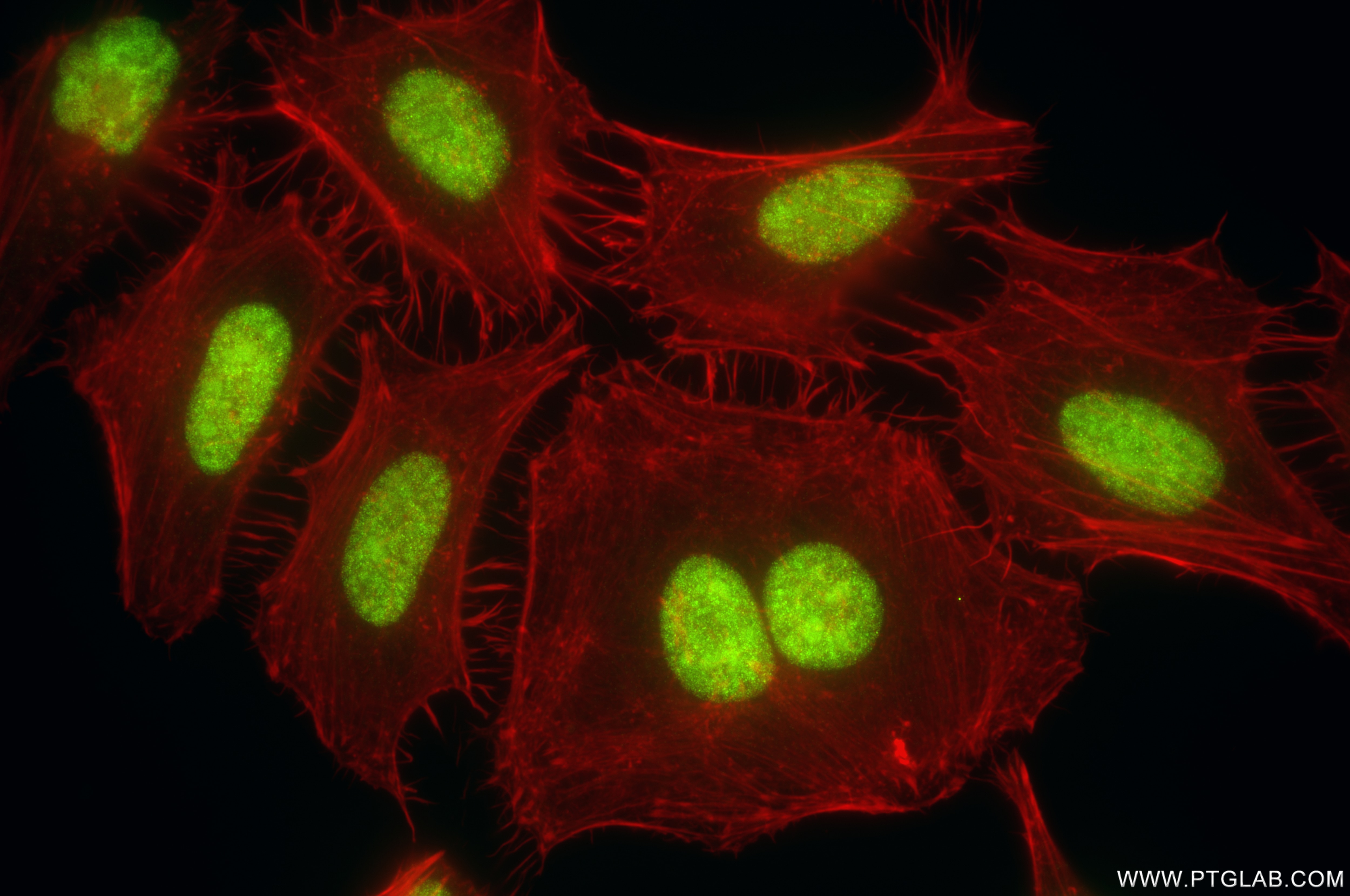Immunofluorescence (IF) / fluorescent staining of HeLa cells using PRPF31 Recombinant antibody (86315-2-RR)