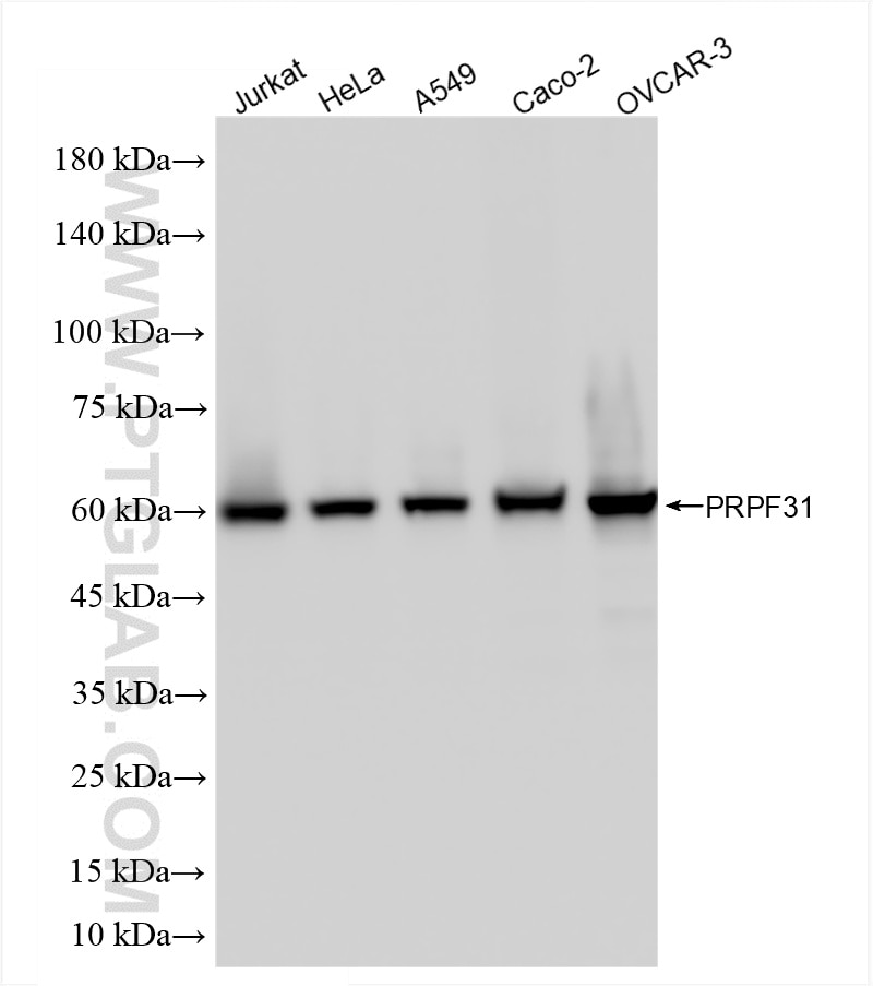Western Blot (WB) analysis of various lysates using PRPF31 Recombinant antibody (86315-2-RR)