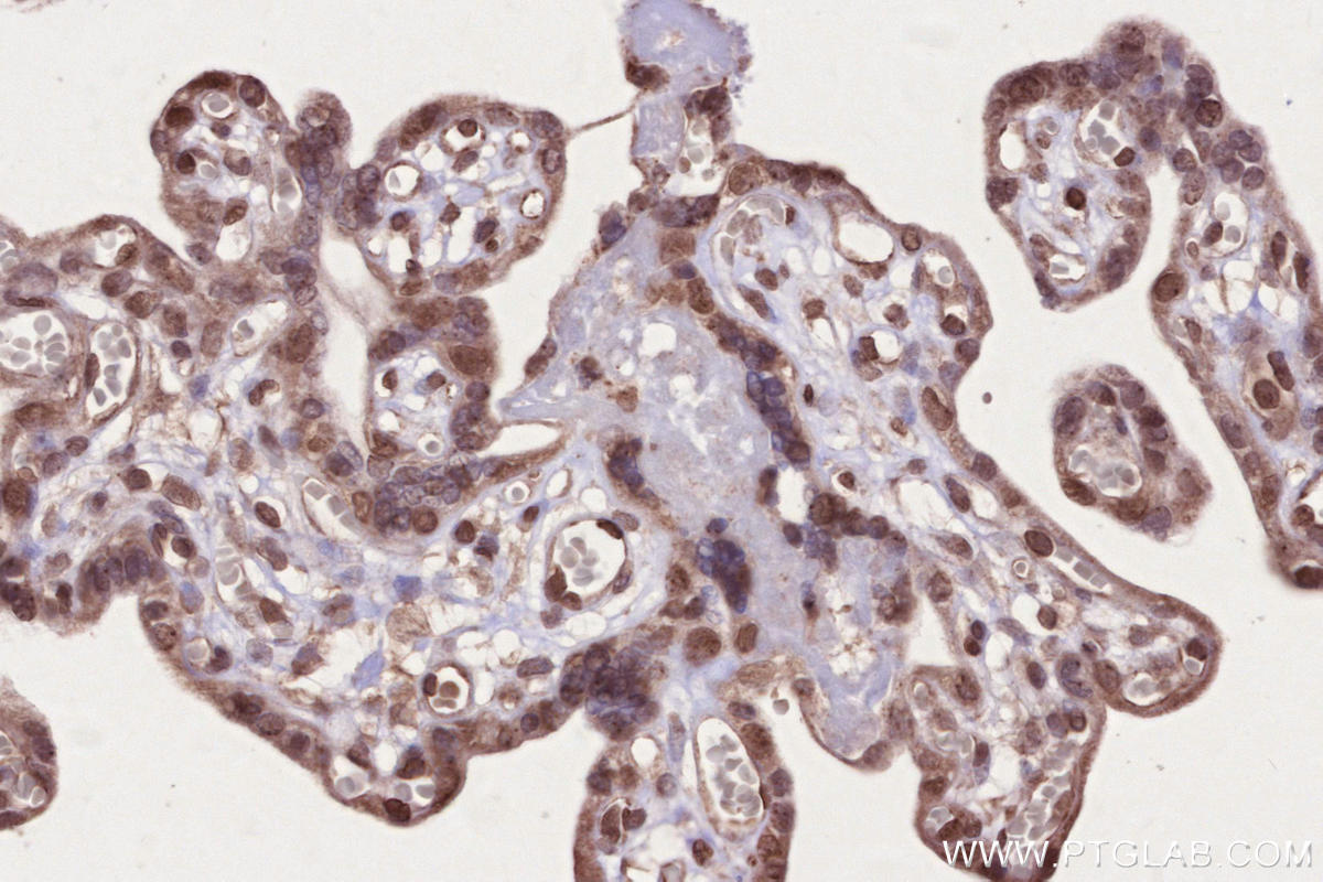 Immunohistochemistry (IHC) staining of human placenta tissue using PRPF38A Polyclonal antibody (24946-1-AP)