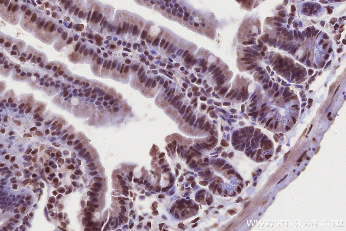 Immunohistochemistry (IHC) staining of mouse small intestine tissue using PRPF38A Polyclonal antibody (24946-1-AP)