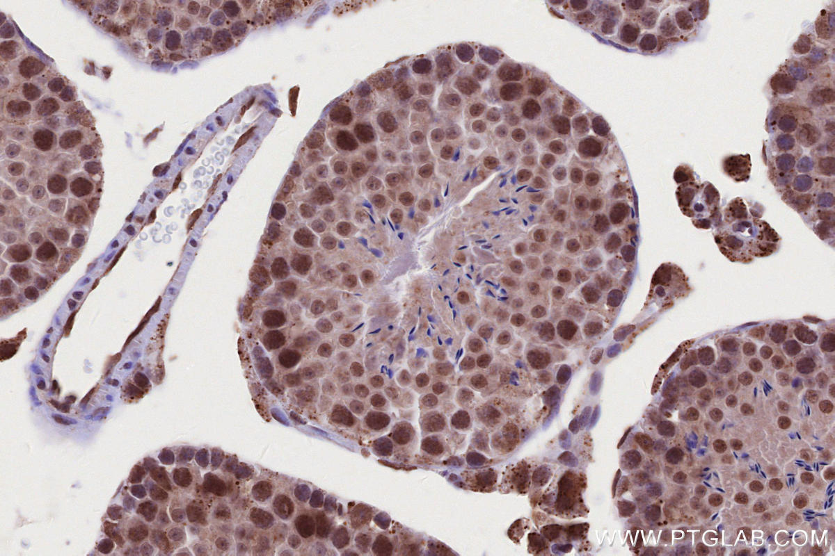 Immunohistochemistry (IHC) staining of mouse testis tissue using PRPF38A Polyclonal antibody (24946-1-AP)