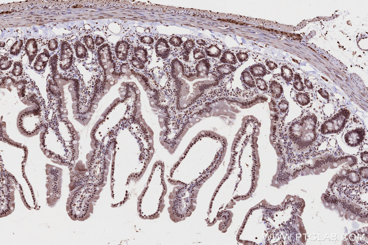 Immunohistochemistry (IHC) staining of rat small intestine tissue using PRPF38A Polyclonal antibody (24946-1-AP)
