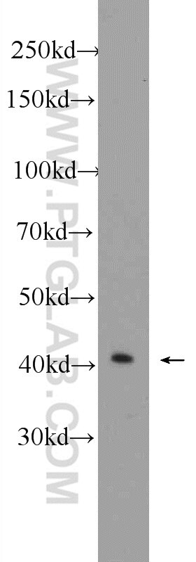 Western Blot (WB) analysis of K-562 cells using PRPF38A Polyclonal antibody (24946-1-AP)