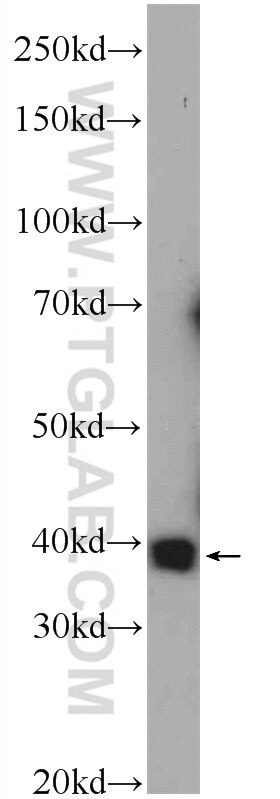 Western Blot (WB) analysis of HepG2 cells using PRPF38A Polyclonal antibody (24946-1-AP)