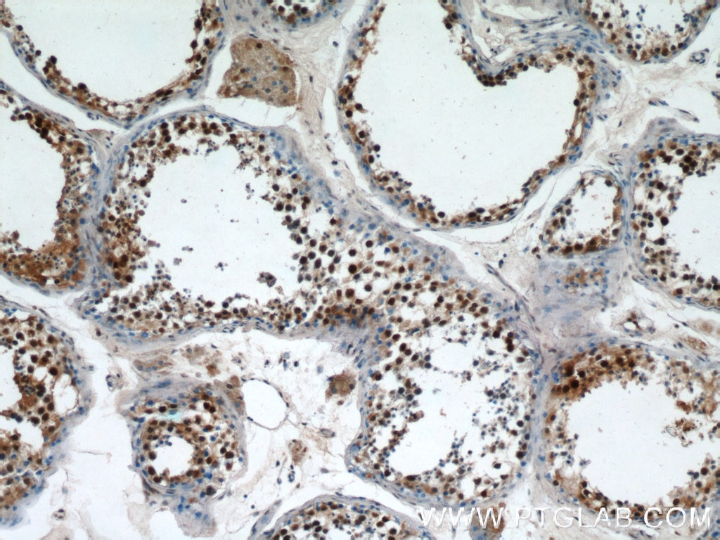 Immunohistochemistry (IHC) staining of human testis tissue using PRPF39 Polyclonal antibody (24480-1-AP)