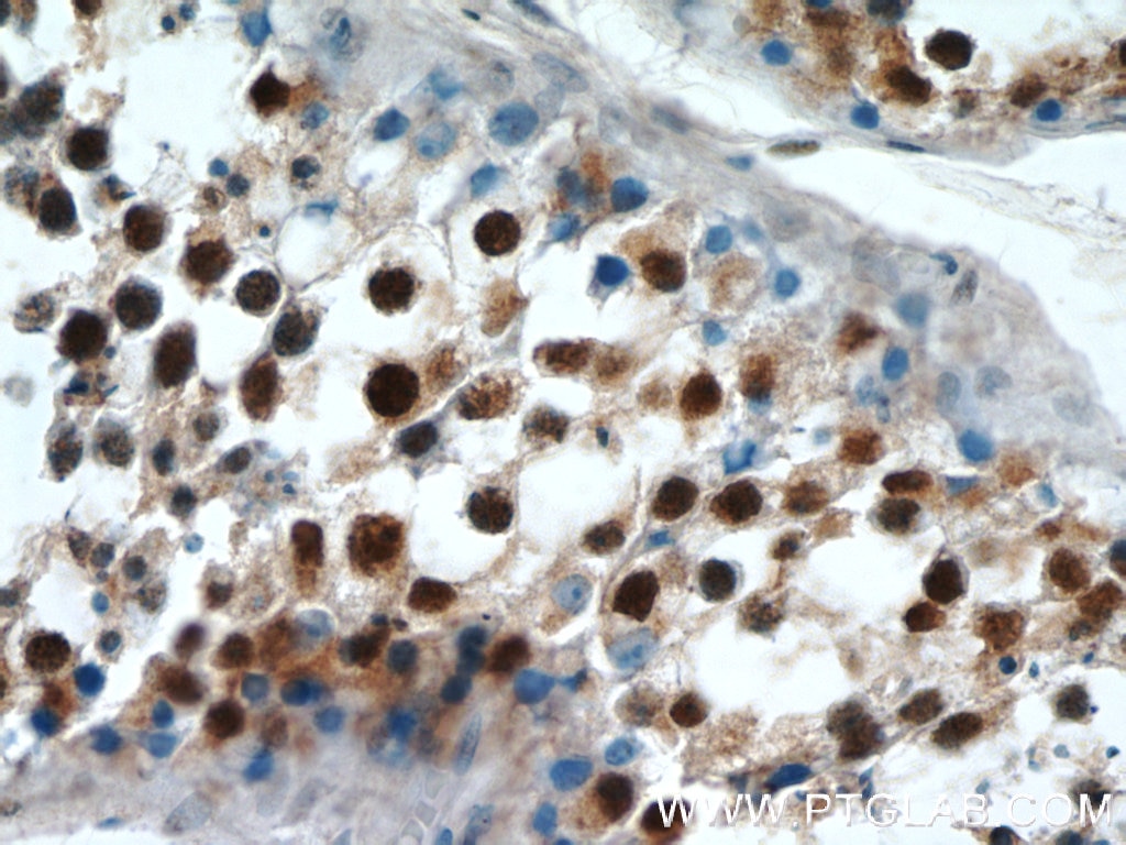 Immunohistochemistry (IHC) staining of human testis tissue using PRPF39 Polyclonal antibody (24480-1-AP)