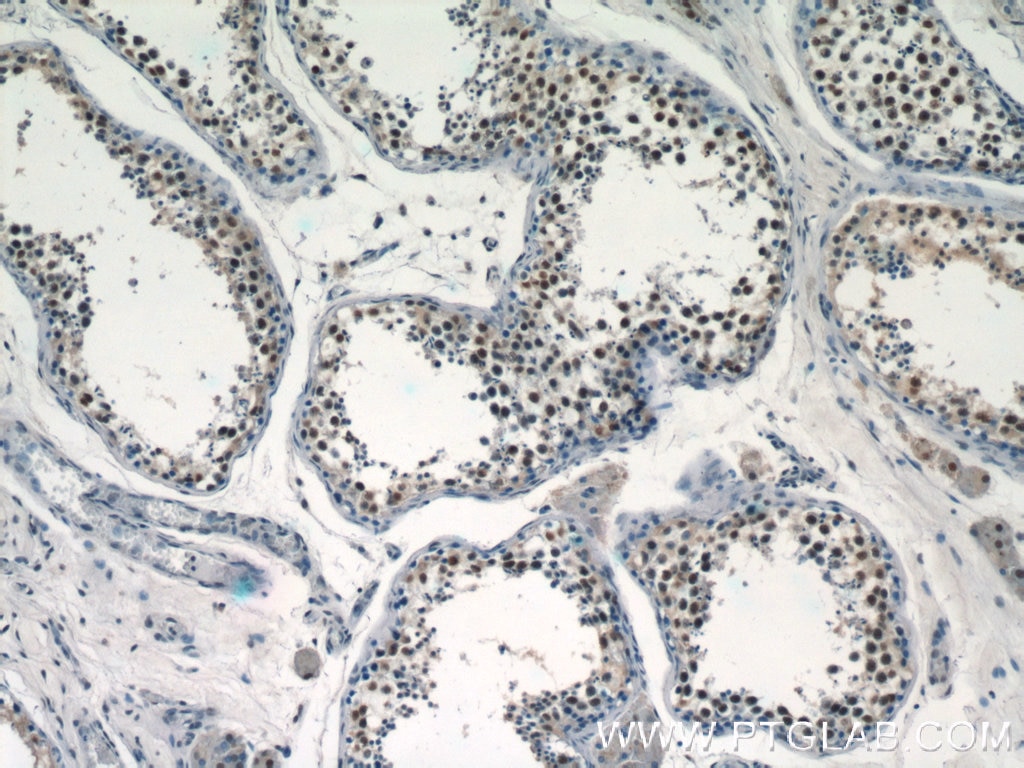 IHC staining of human testis using 24480-1-AP