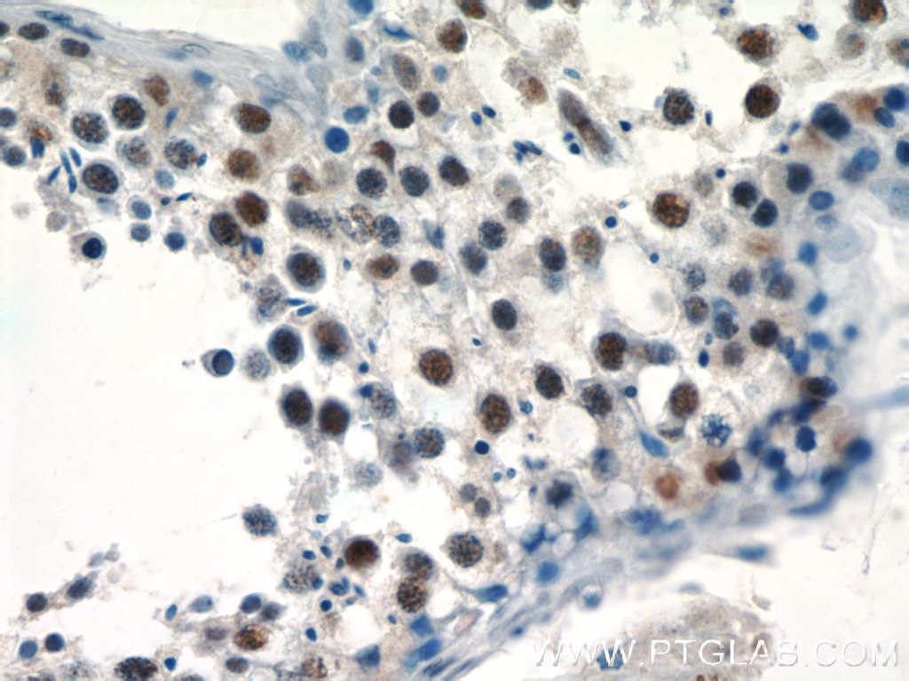 Immunohistochemistry (IHC) staining of human testis tissue using PRPF39 Polyclonal antibody (24480-1-AP)