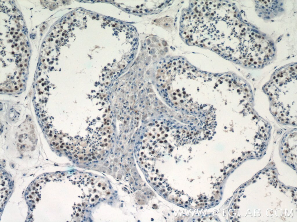 IHC staining of human testis using 24480-1-AP