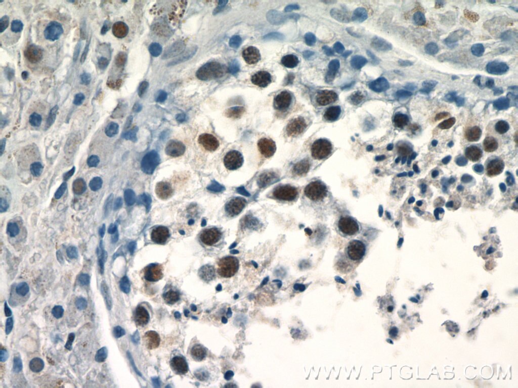 Immunohistochemistry (IHC) staining of human testis tissue using PRPF39 Polyclonal antibody (24480-1-AP)