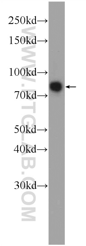 Western Blot (WB) analysis of COLO 320 cells using PRPF39 Polyclonal antibody (24480-1-AP)
