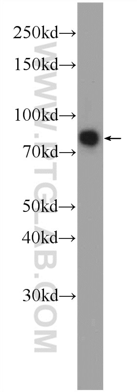 WB analysis of COLO 320 using 24480-1-AP